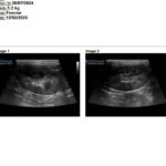 Echographie rénale d'un Maine Coon de la chatterie de la voie féline
