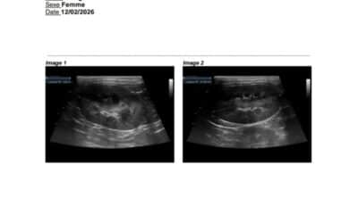 Pourquoi les échographies cardiaques et rénales sont essentielles chez les chats de reproduction