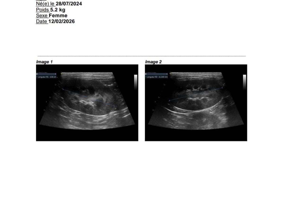 Echographie rénale d'un Maine Coon de la chatterie de la voie féline