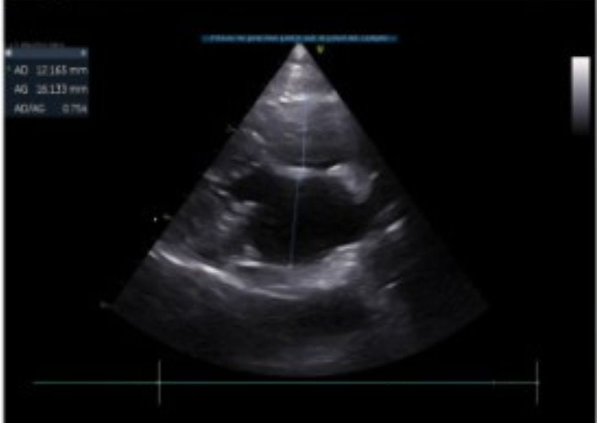 Echographie cardiaque tiger chatterie de la voie féline 
