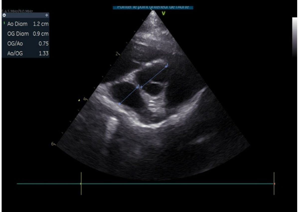 Echographie cardiaque tiger chatterie de la voie féline 