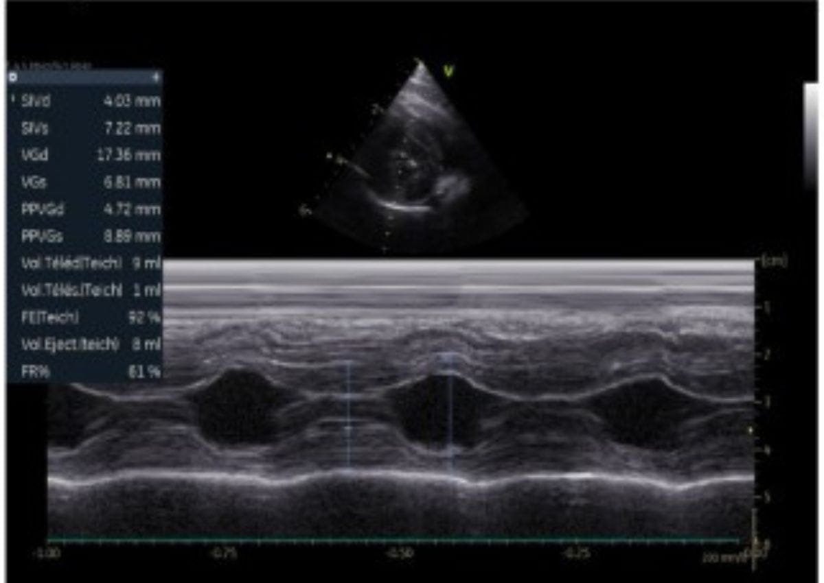 Echographie cardiaque tiger chatterie de la voie féline 